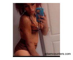 REDBONE FREAK SPECIAL - Escort - Buffalo NY